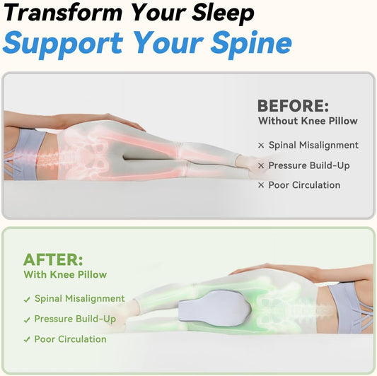 UJPFEO Knee Pillow for Side Sleepers,Leg Pillows for Sciatica,Knees,Hips,Joints Between Legs,Back Pain Relief When Side Sleeping Spine Alignment Support for Knee Surgery Recovery