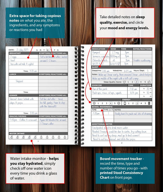 Food Diary and Symptom Log - Track How Your Diet Affects Your Symptoms | for IBS, Allergies, Intolerance, Crohn’s/IBD | A5 (5.8” x 8.3”) Spiral Bound