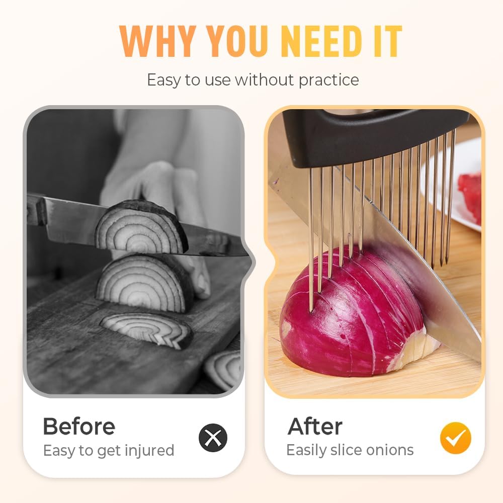 Onion Holder for Slicing, Stainless Steel Onion Slicer Holder, 2025 New Upgraded Tamato Slicer Vegetable Cutter Kitchen Gadeget Chopper Assistant Tool for Potato Lemon Fruit and Meat (2pcs)