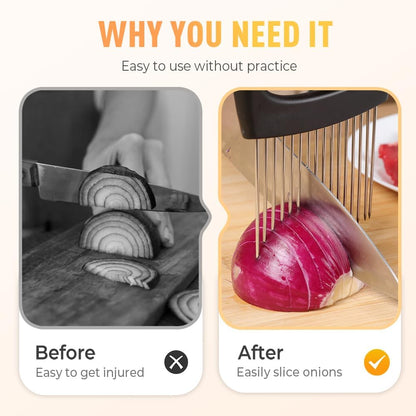 Onion Holder for Slicing, Stainless Steel Onion Slicer Holder, 2025 New Upgraded Tamato Slicer Vegetable Cutter Kitchen Gadeget Chopper Assistant Tool for Potato Lemon Fruit and Meat (2pcs)