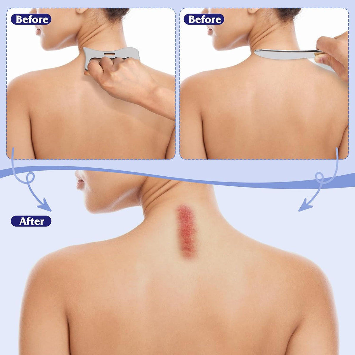 Gua Sha Scraping Tool Stainless Steel, Body Massage for Neck Back