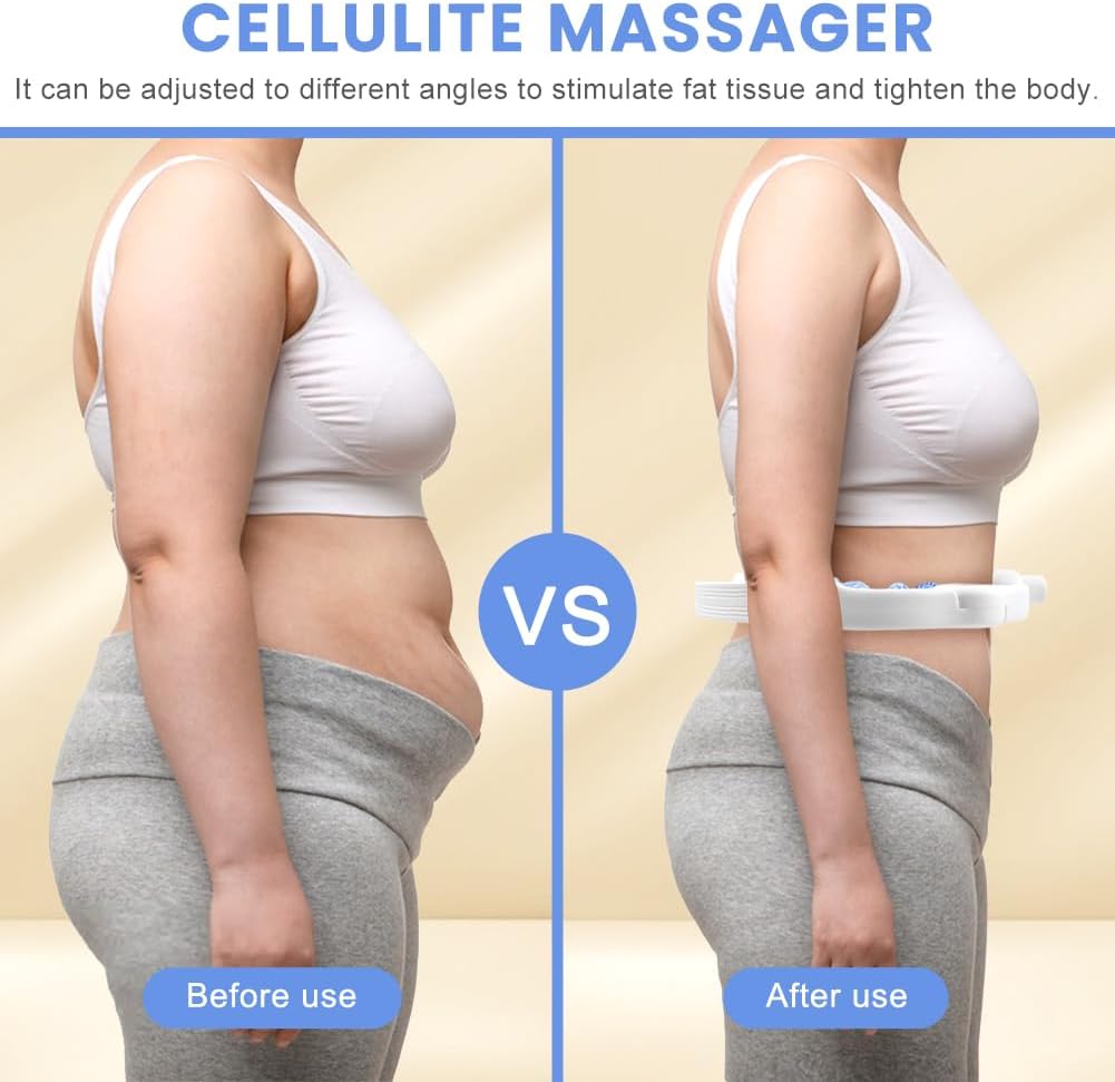 Cellulite Remover Massager – Detachable Handles, Smooth Glide for Legs & Arms, Skin Tightening