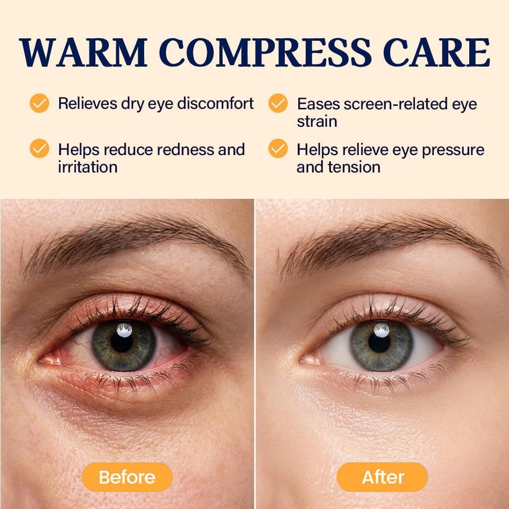 30 Pack Self-Heating Steam Eye Masks for Dry Eyes: Moist Heat Warm Compress