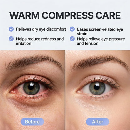 30 Pack Self-Heating Steam Eye Masks for Dry Eyes: Moist Heat Warm Compress