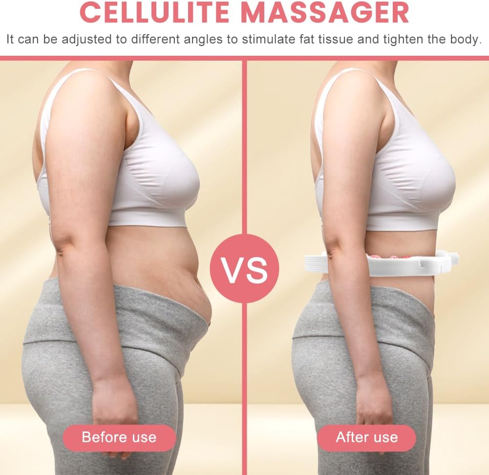 Cellulite Remover Massager – Detachable Handles, Smooth Glide for Legs & Arms, Skin Tightening