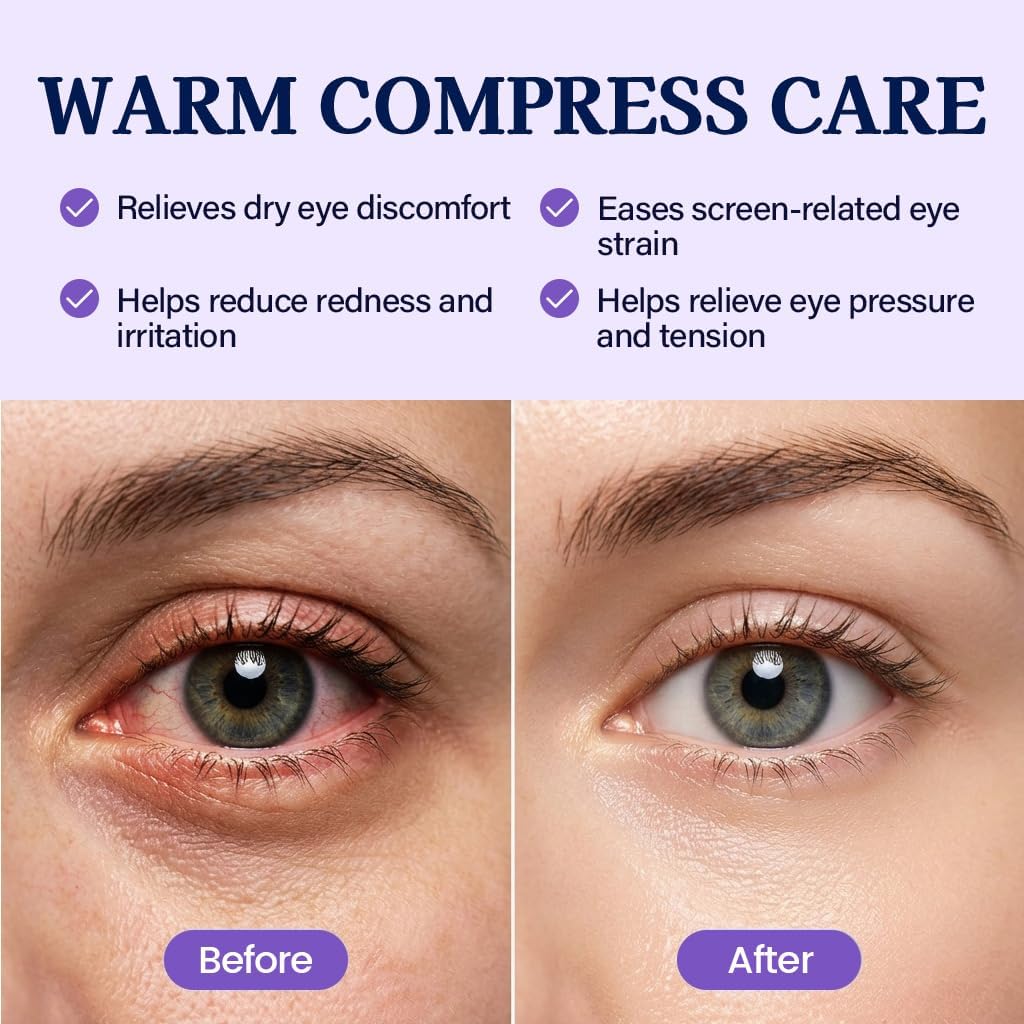 30 Pack Self-Heating Steam Eye Masks for Dry Eyes: Moist Heat Warm Compress