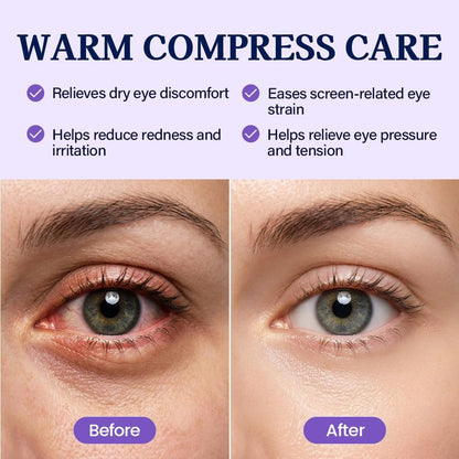 30 Pack Self-Heating Steam Eye Masks for Dry Eyes: Moist Heat Warm Compress