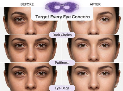 Cooling Gel Eye Mask for Puffy Eyes & Migraine Relief – Reusable Hot & Cold Therapy Mask for Sinus Pressure, Dark Circles, Headache Relief (Purple)