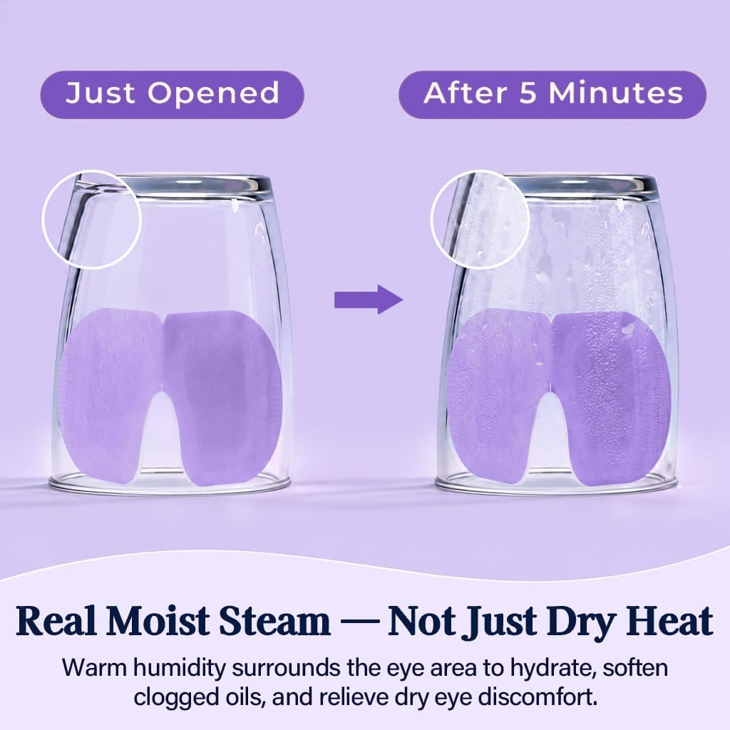 30 Pack Self-Heating Steam Eye Masks for Dry Eyes: Moist Heat Warm Compress