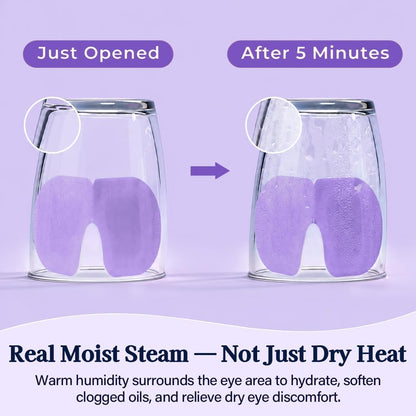 30 Pack Self-Heating Steam Eye Masks for Dry Eyes: Moist Heat Warm Compress