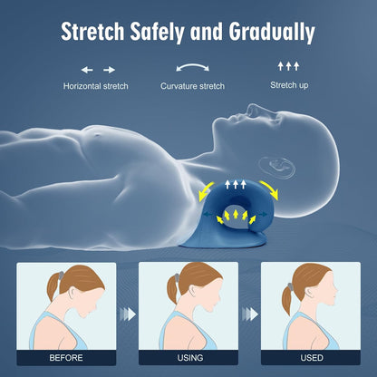 Neck Stretcher for Pain Relief, Neck and Shoulder Relaxer Cervical Traction Device Pillow for Muscle Relax and TMJ Pain Relief (Blue)