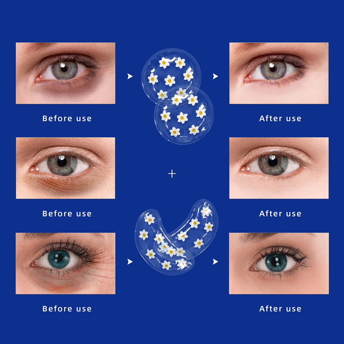 ZNÖCUETÖD Gel Ice Pack Reusable Cooling Eye Pads and Under Eye Patches