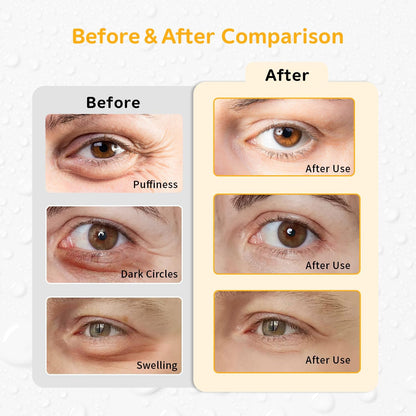 4PCS Gel Eye Ice Pack Set Reusable, Cold and Hot Compress for Eyes, Ice Pack for Eyes, Cooling Eye Pads for Eye Strain, Swelling, Redness, Dark Circles, Puffy Eyes, and Eye Recovery Surgery.