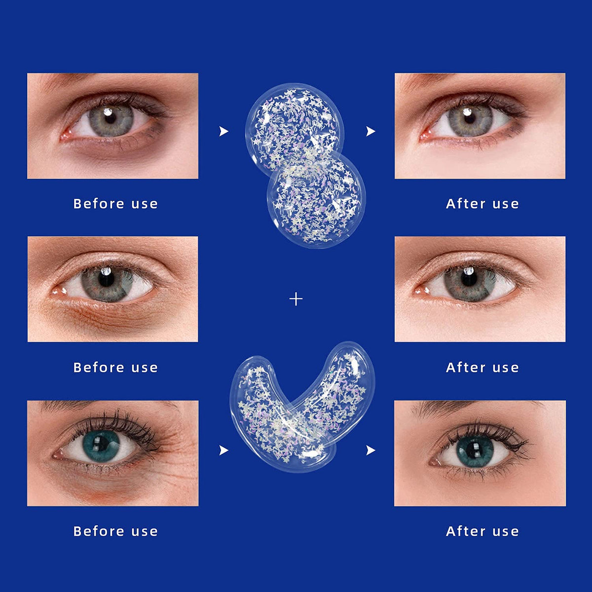 ZNÖCUETÖD Gel Ice Pack Reusable Cooling Eye Pads and Under Eye Patches