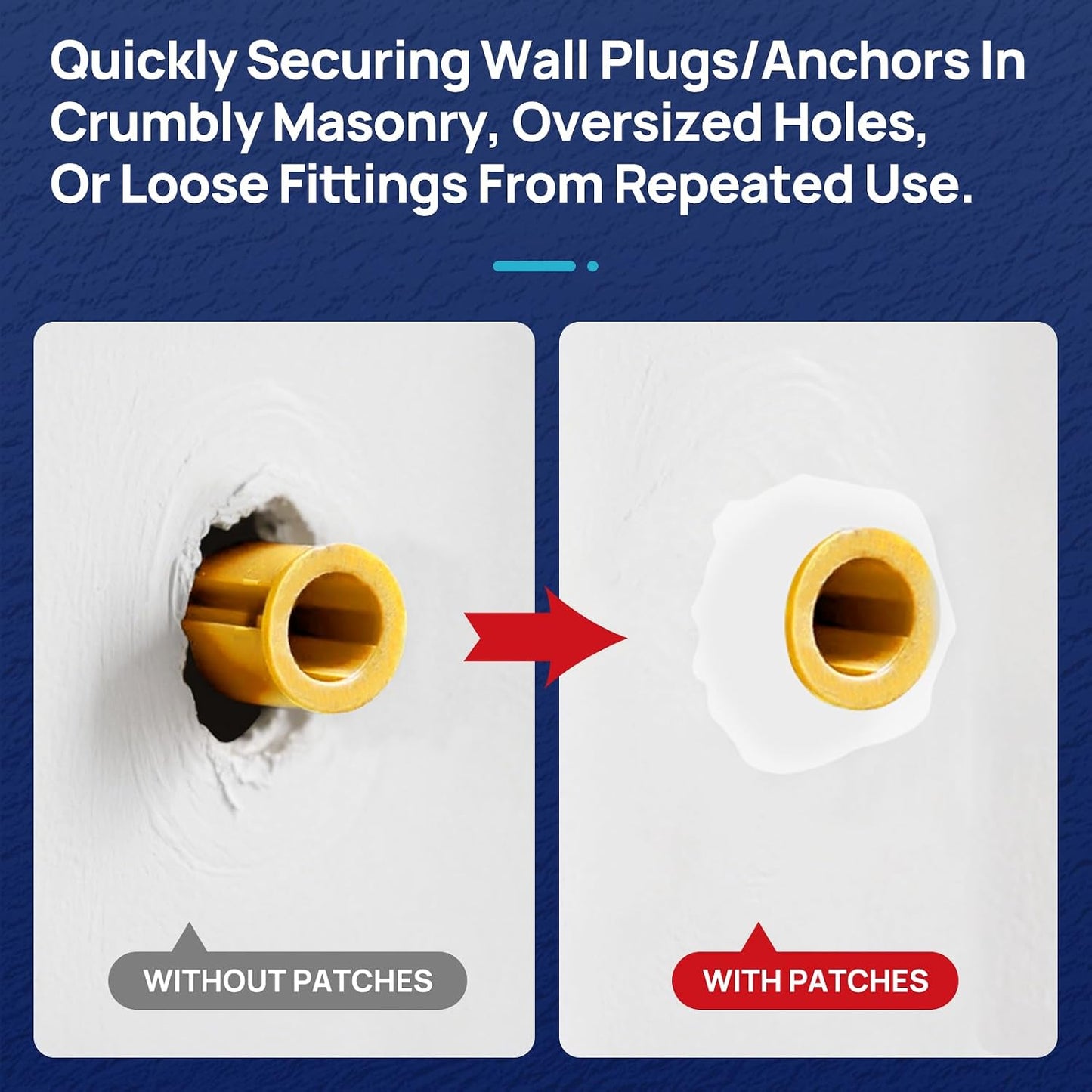 WRAPNLOCK Drywall Anchor Repair Kit - Fast Loose Anchor Fix | No Fill/Redrill. Includes 22 Patches, Screws, Anchors, Screwdriver & Gloves. Perfect For Home Fittings.