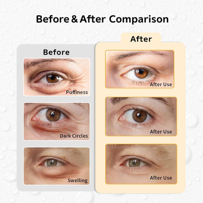 4PCS Gel Eye Ice Pack Set Reusable, Cold and Hot Compress for Eyes, Ice Pack for Eyes, Cooling Eye Pads for Eye Strain, Swelling, Redness, Dark Circles, Puffy Eyes, and Eye Recovery Surgery.