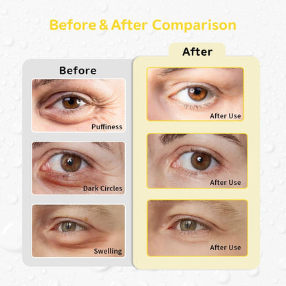 4PCS Gel Eye Ice Pack Set Reusable, Cold and Hot Compress for Eyes, Ice Pack for Eyes, Cooling Eye Pads for Eye Strain, Swelling, Redness, Dark Circles, Puffy Eyes, and Eye Recovery Surgery.