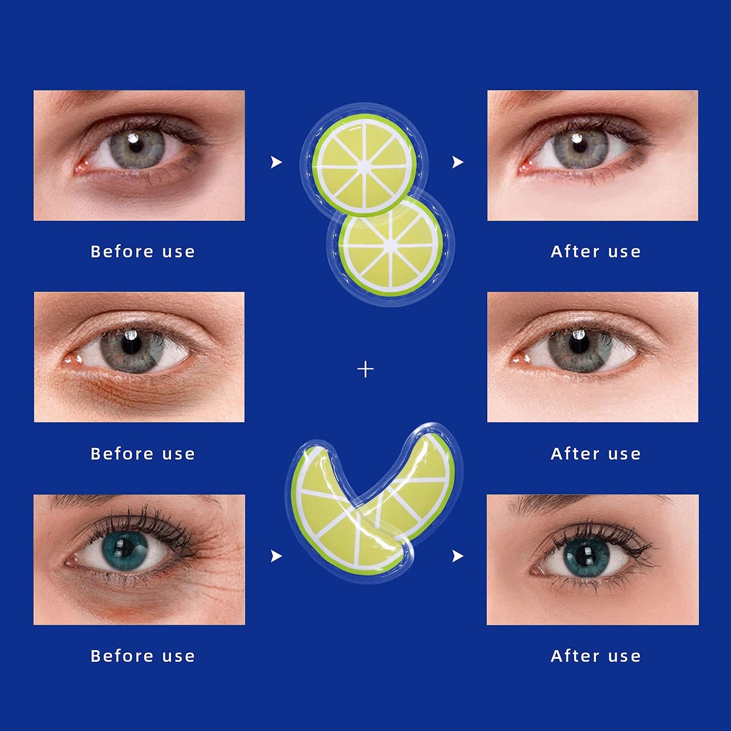 ZNÖCUETÖD Gel Ice Pack Reusable Cooling Eye Pads and Under Eye Patches,Eye Hot Cold Treatment Pack for Redness,Pain Relief and Eye Relax