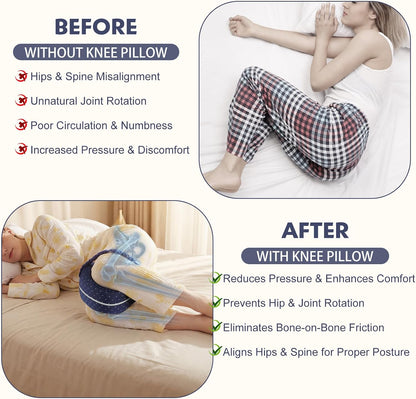 Revoget Alignment Pillow for Side Sleepers, Relieve Leg Pain & Sciatica 2026 New Knee Pillow for Side Sleepers, Hips Buttocks Back Sciatica Relief Pillow with Adjustable Strap (Star Blue)