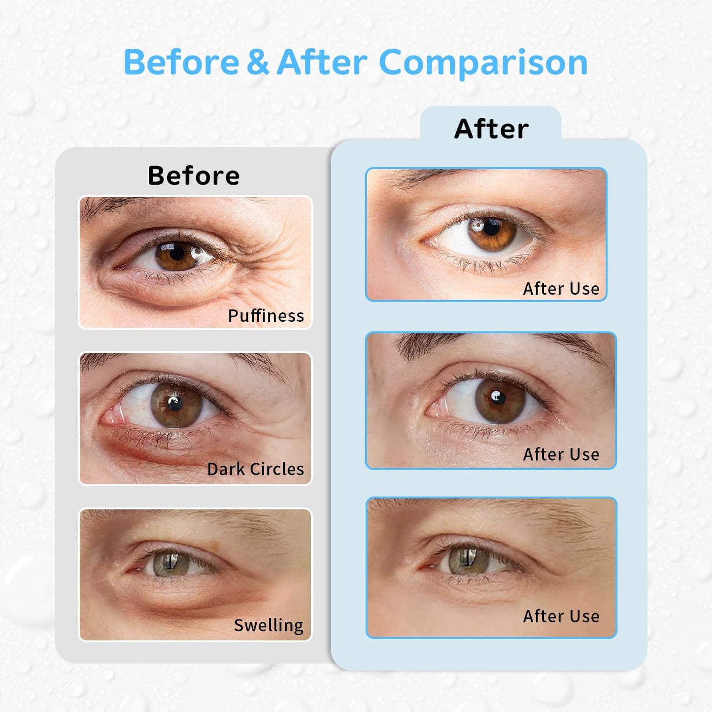 4PCS Gel Eye Ice Pack Set Reusable, Cold and Hot Compress for Eyes, Ice Pack for Eyes, Cooling Eye Pads for Eye Strain, Swelling, Redness, Dark Circles, Puffy Eyes, and Eye Recovery Surgery.