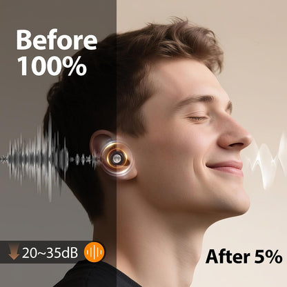 Reusable Sleep Noise-Canceling Earplugs, High-Fidelity Hearing Protection Earplugs, Ideal for Concerts, Travel, Library, Sleep, and Deep Focus Work | 20-35dB Noise Reduction(White)