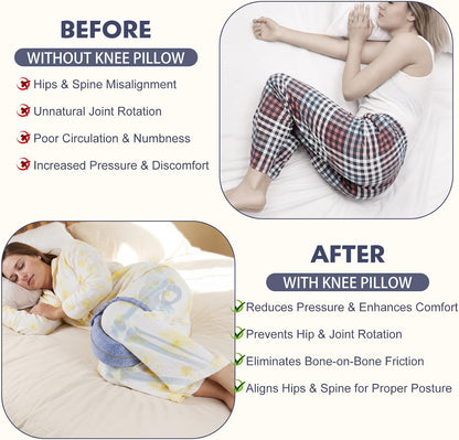 Revoget Alignment Pillow for Side Sleepers, Relieve Leg Pain & Sciatica 2026 New Knee Pillow for Side Sleepers, Hips Buttocks Back Sciatica Relief Pillow with Adjustable Strap (Star Blue)