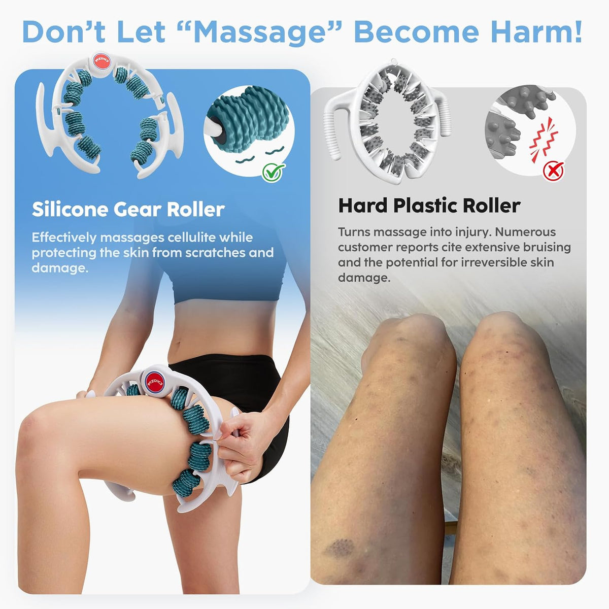 Cellulite Massage Tool - Lymphatic Drainage Massager - Muscle Roller, Deep Fascia Massage, Dimpled Skin Removal, Legs/Thighs/Buttocks, Anti-Cellulite Roller, Smooth Skin (14 Wheel - Green)