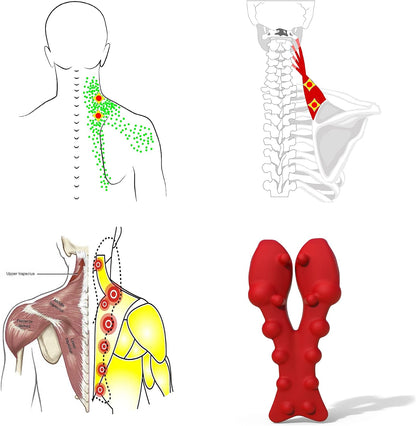 LittleMum Trapezius Trigger Point Massager for Neck, Shoulder & Upper Back
