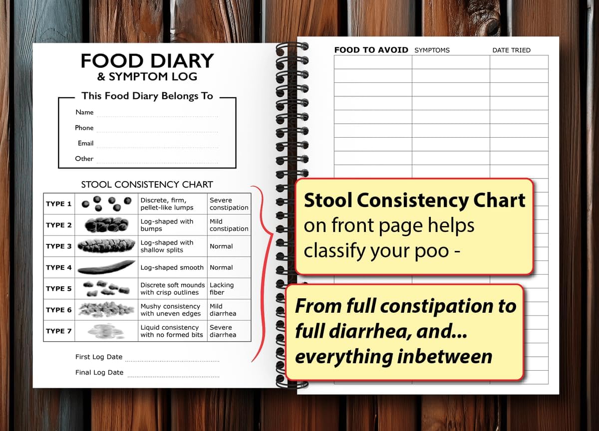 Food Diary and Symptom Log - Track How Your Diet Affects Your Symptoms | for IBS, Allergies, Intolerance, Crohn’s/IBD | A5 (5.8” x 8.3”) Spiral Bound