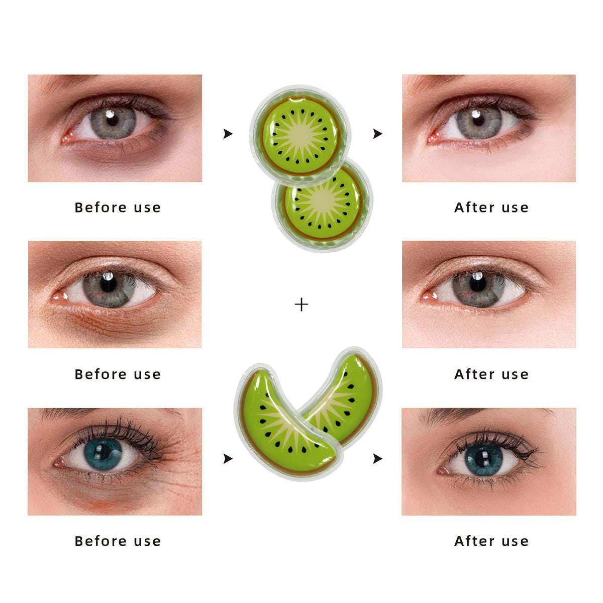 ZNÖCUETÖD Gel Ice Pack Reusable Cooling Eye Pads and Under Eye Patches
