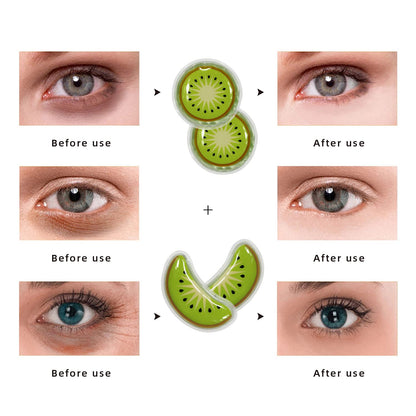 ZNÖCUETÖD Gel Ice Pack Reusable Cooling Eye Pads and Under Eye Patches