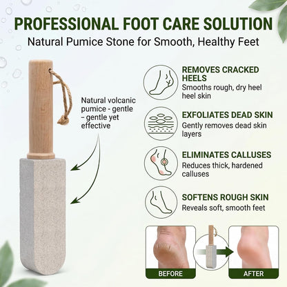 Pumice Stone 2-Pack Handle, Non-Scratch Toilet & Foot Cleaner | 2-in-1 Pumice Stone: Erases rust, hard water rings & calluses. Non-scratch handle, shapes to fit tight spots.