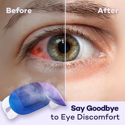 45-Min Self-Heating Steam Eye Masks for Dry Eyes & Stye 20 Pack